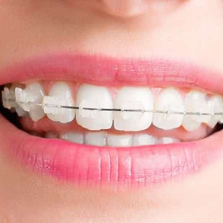 Diseño sin título (1)